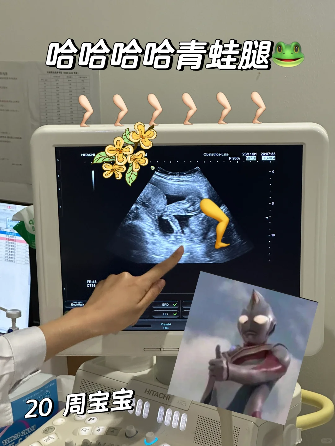 哈哈哈哈哈哈这美腿要笑死老母亲,代孕流程费用